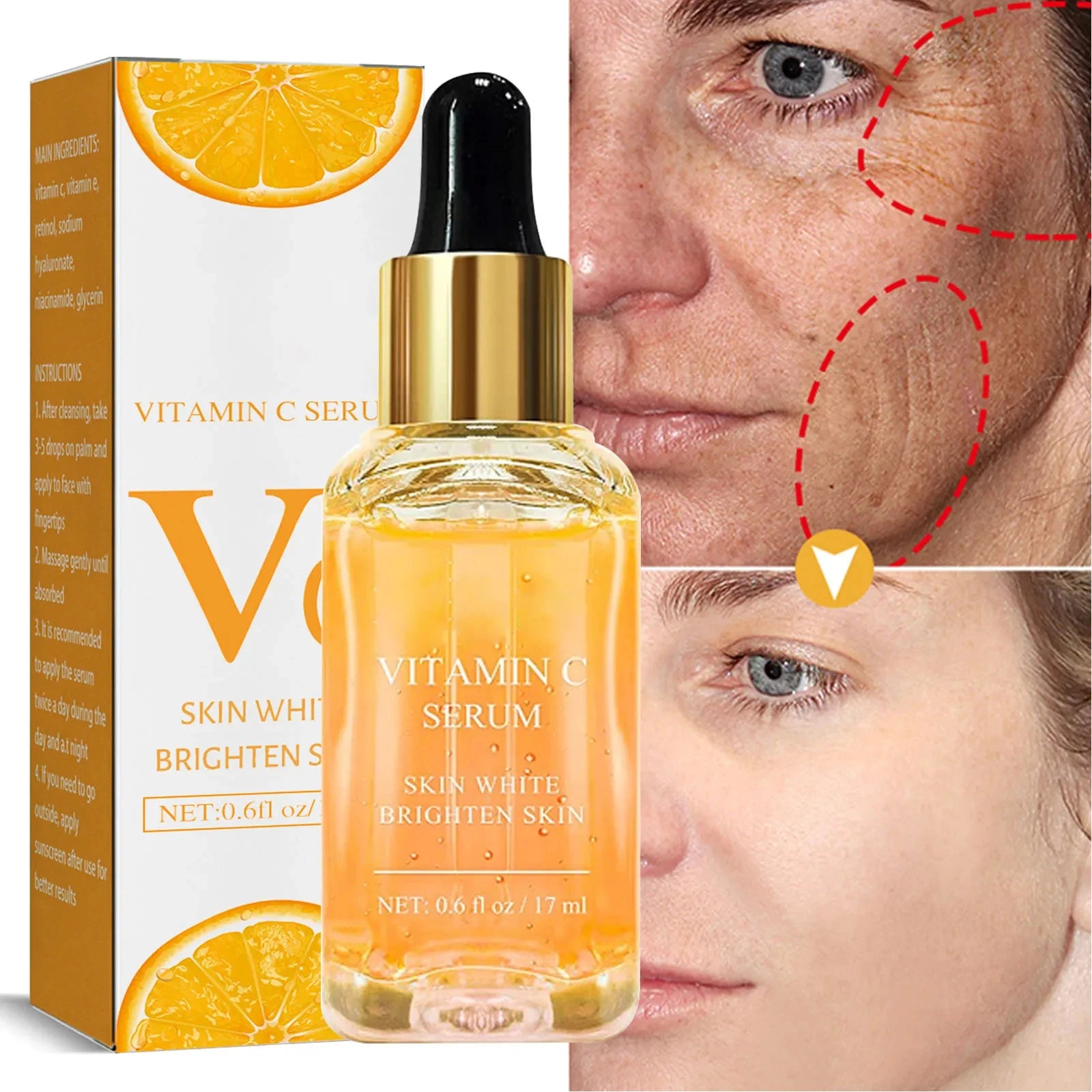 Vitamin C Whitening Serum: Dark Spot and Freckle Removal, Anti-Wrinkle Retinol Essence for Brightening - Korean Skincare