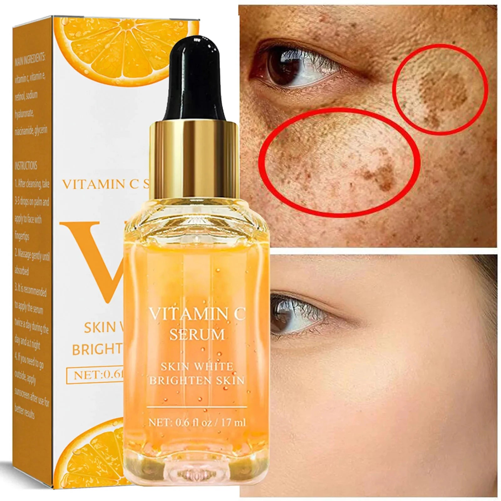 Vitamin C Whitening Serum: Dark Spot and Freckle Removal, Anti-Wrinkle Retinol Essence for Brightening - Korean Skincare